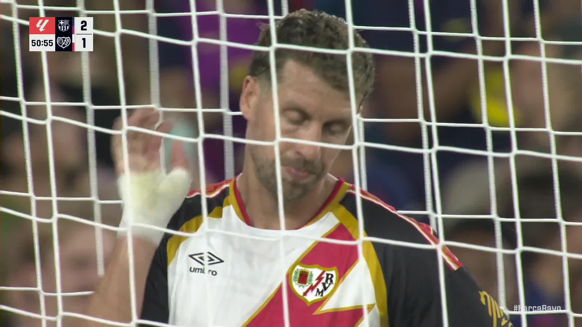 Match clip